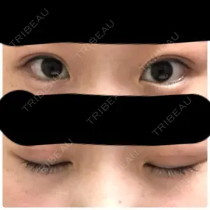 103 days after image