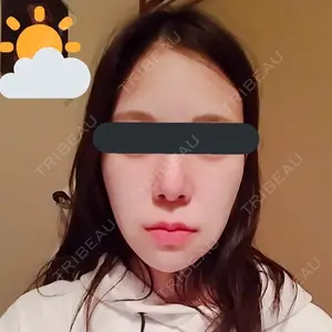 21 days after image