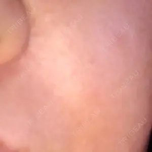 31 days after image