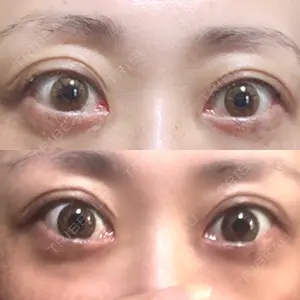 354 days after image