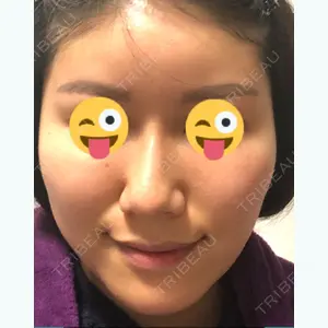 7 days after image
