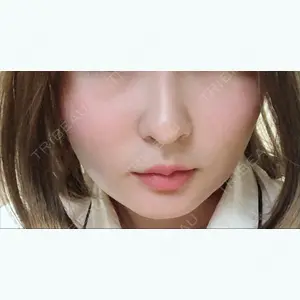 90 days after image
