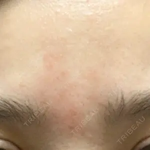61 days after image