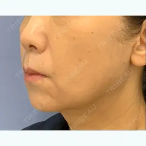 湘南美容クリニック 湘南美容クリニック 秋葉原院口コミ