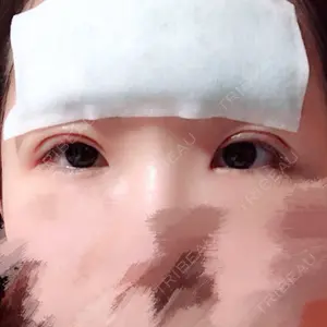 0 days after image