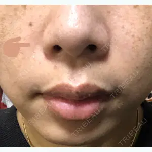 TAクリニック 新宿TAクリニック口コミ
