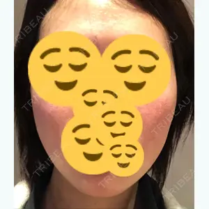 7 days after image