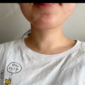 1 days after image