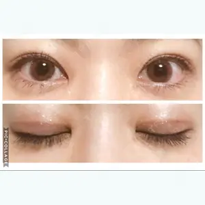 130 days after image