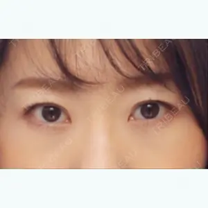 84 days after image