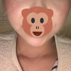 18 days after image