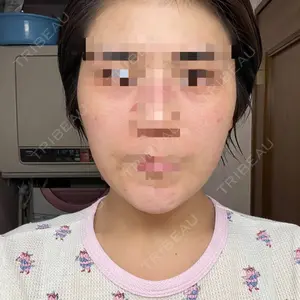 4 days after image