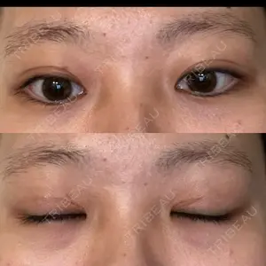 31 days after image