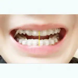 1016 days after image