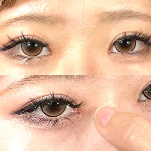藤・ナチュレ美容クリニック 藤・ナチュレ美容クリニック 恵比寿院口コミ