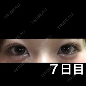 7 days after image