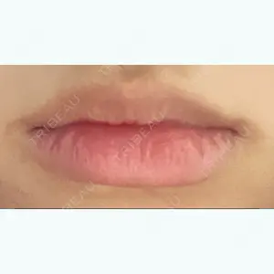 109 days after image