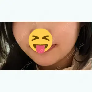 TCB東京中央美容外科 町田院の山崎 智徳医師口コミ