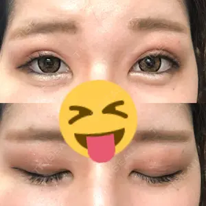 さくら美容外科口コミ