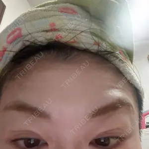 3 days after image