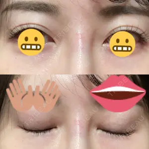 湘南美容クリニック 湘南美容クリニック Regno 銀座院口コミ
