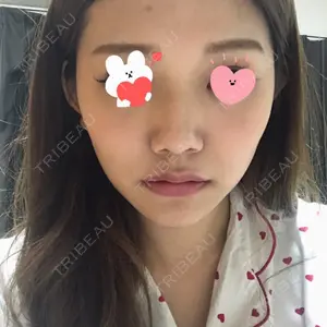 3 days after image
