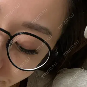 1 days after image