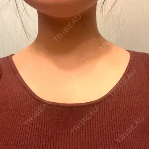 26 days after image