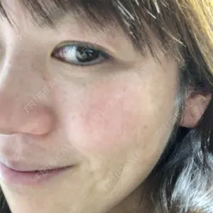 3 days after image