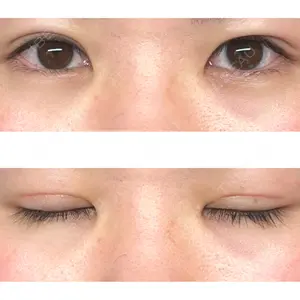 水の森美容クリニック 東京新宿院の鈴木 凛医師口コミ