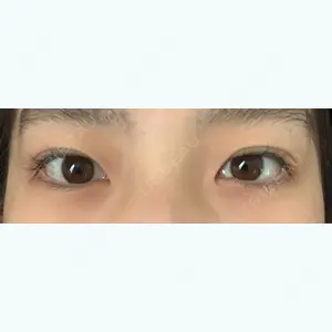 12 days after image