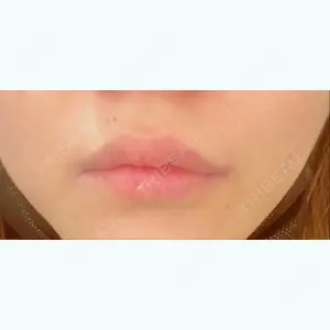銀座美容外科クリニック 銀座院の近藤 紀子医師口コミ