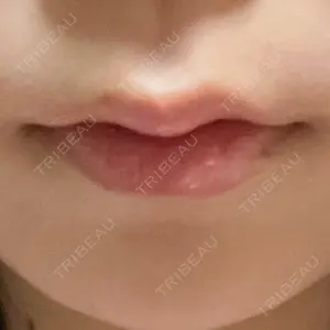 フィラークリニック フィラークリニック 新宿院口コミ