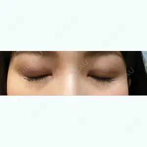 あいち栄クリニック あいちビューティークリニック口コミ