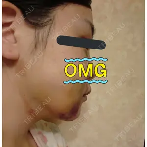 8 days after image