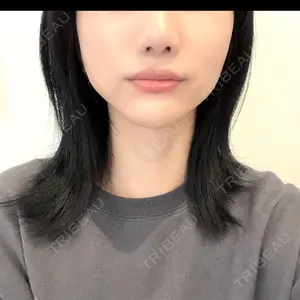 14 days after image