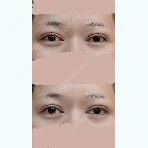 29 days after image
