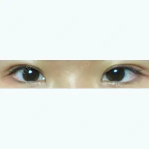 TCB東京中央美容外科 TCB東京中央美容外科 名古屋栄院口コミ