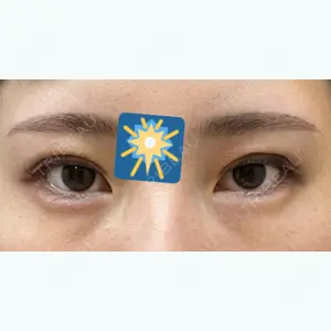 10 days after image