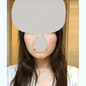 98 days after image