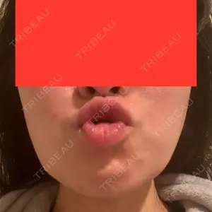 TCB東京中央美容外科 TCB東京中央美容外科 渋谷西口院口コミ