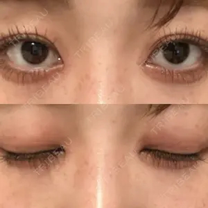 12 days after image