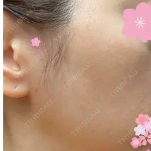 10 days after image