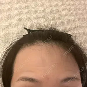 TCB東京中央美容外科 TCB東京中央美容外科 川口院口コミ