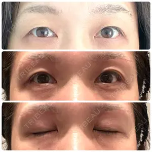32 days after image