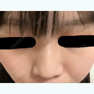 TCB東京中央美容外科 TCB東京中央美容外科 渋谷西口院口コミ