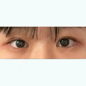 東京イセアクリニックの吉種 克之医師口コミ