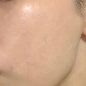 42 days after image