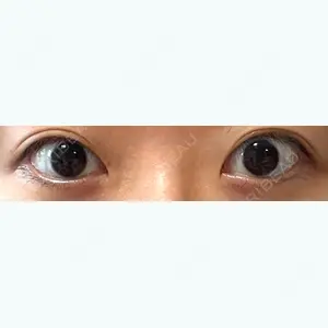 共立美容外科 新宿本院の新妻 克宜医師口コミ