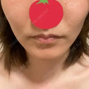 10 days after image